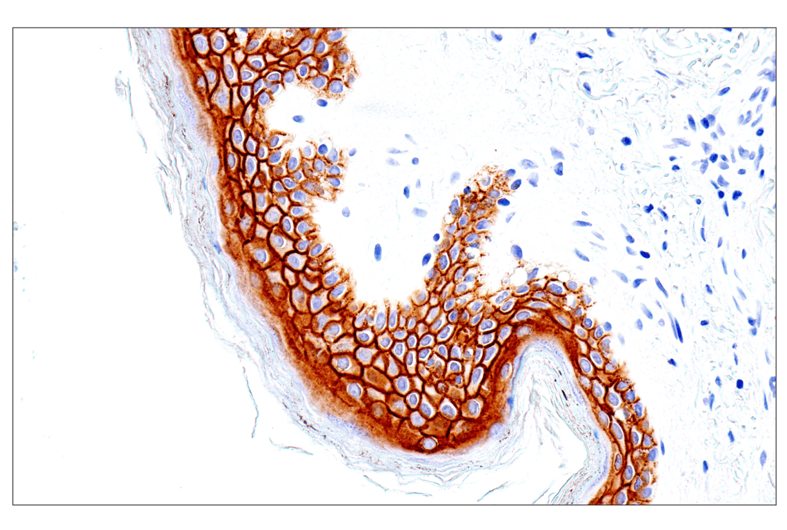 agt様 Anti-Japanese encephalitis virus NS5 antibody (GTX131359
