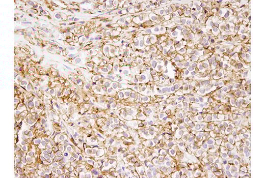 Immunohistochemistry Image 1: Phospho-Ezrin (Thr567)/Radixin (Thr564)/Moesin (Thr558) (48G2) Rabbit Monoclonal Antibody (BSA and Azide Free)