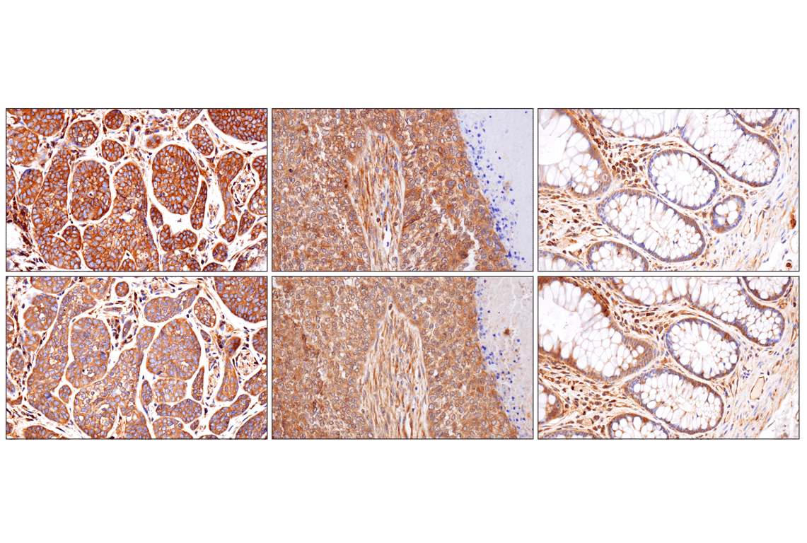 Immunohistochemistry Image 7: NF-kappaB p65 (D14E12) Rabbit Monoclonal Antibody (BSA and Azide Free)