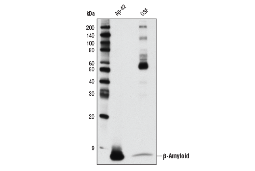 Western Blotting Image 3: beta-Amyloid (D54D2) Rabbit Monoclonal Antibody