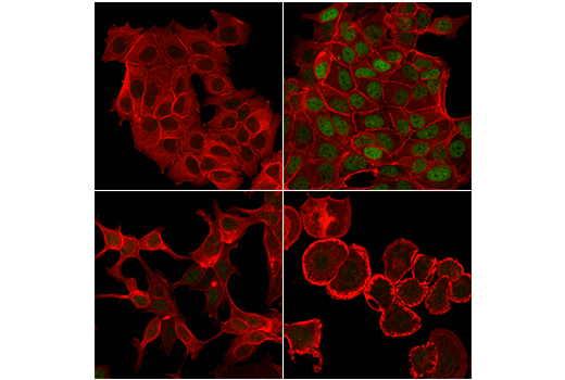 undefined Image 9: Estrogen Receptor alpha Activation Antibody Sampler Kit
