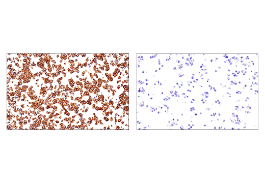 NCAM1 (CD56) (E7X9M) XP® Rabbit mAb (BSA and Azide Free
