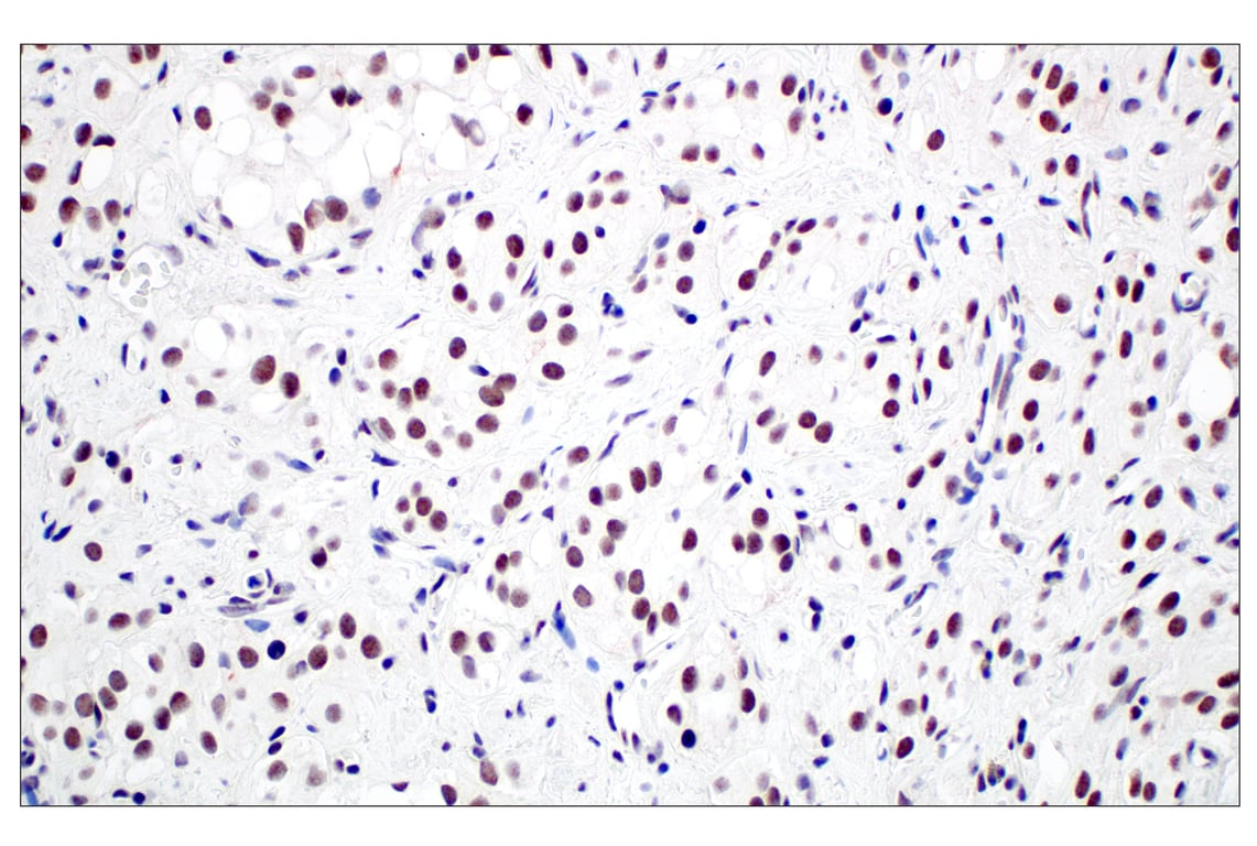 Immunohistochemistry Image 5: Menin (E5P1R) Rabbit Monoclonal Antibody
