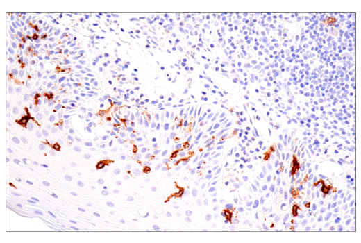 Immunohistochemistry Image 2: CD1A (MTB1) Mouse Monoclonal Antibody