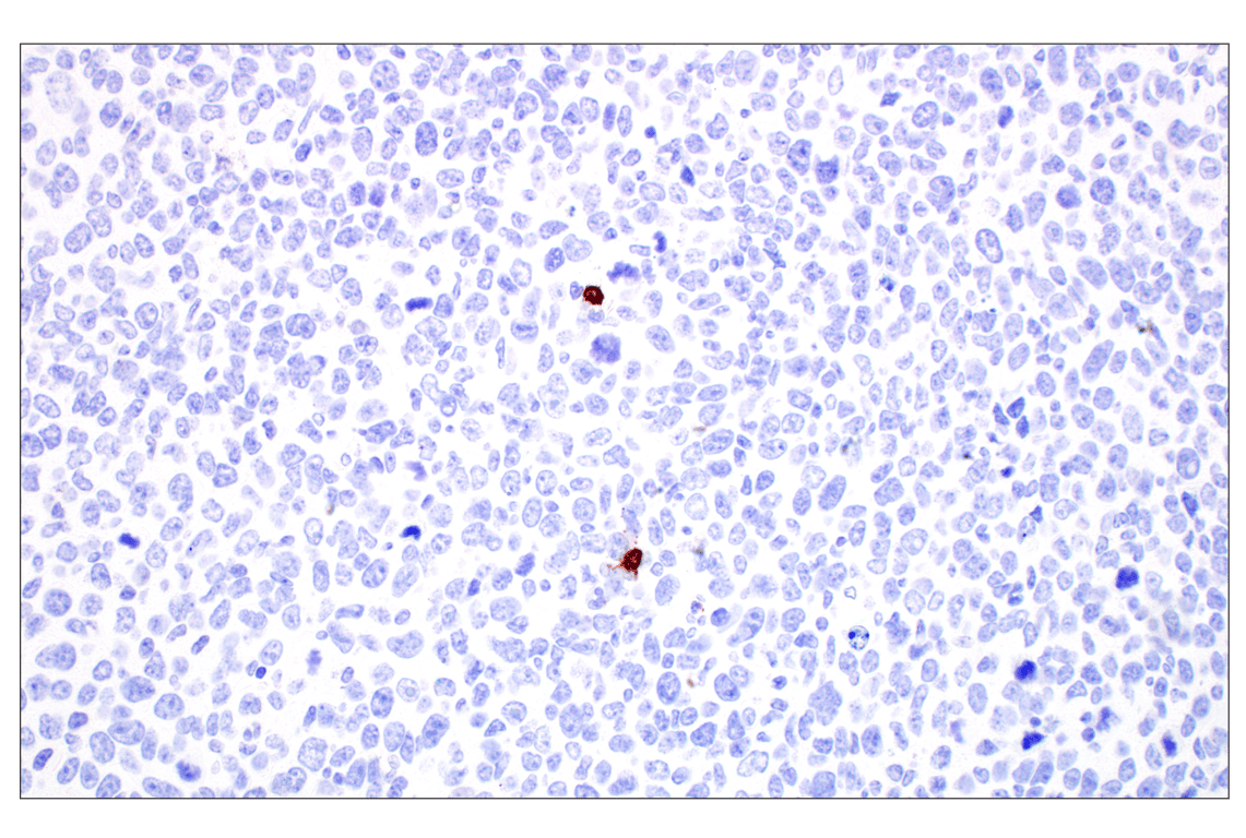 Immunohistochemistry Image 2: CD20 (E3N7O) Rabbit Monoclonal Antibody