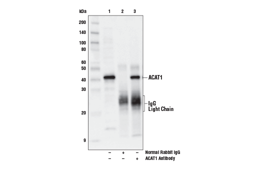 Immunoprecipitation Image 1: ACAT1 Antibody