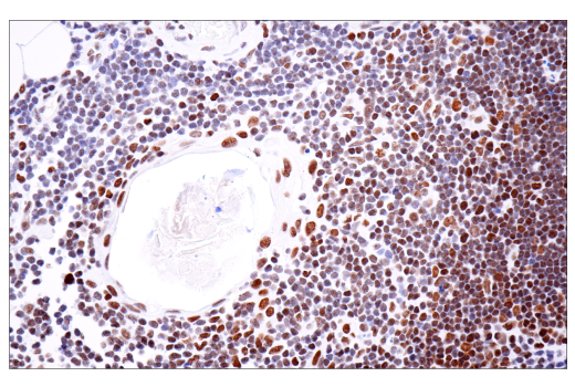 Immunohistochemistry Image 8: PBRM1/BAF180 (D4L9X) Rabbit Monoclonal Antibody