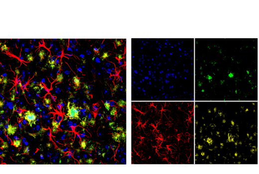 undefined Image 23: Pathological Hallmarks of Alzheimer's Disease Antibody Sampler Kit