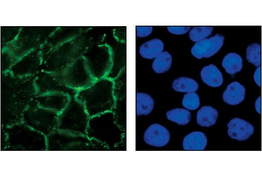 Immunofluorescence Image 1: P-Cadherin Antibody