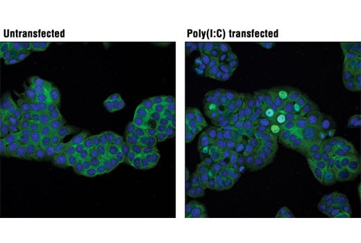 undefined Image 20: Rig-I Pathway Antibody Sampler Kit