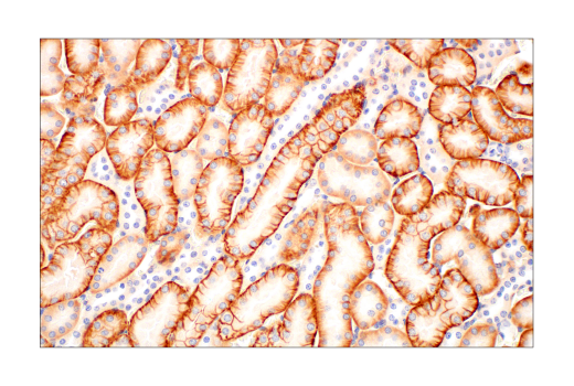 Immunohistochemistry Image 8: CMTM6 (E6A8T) Rabbit Monoclonal Antibody