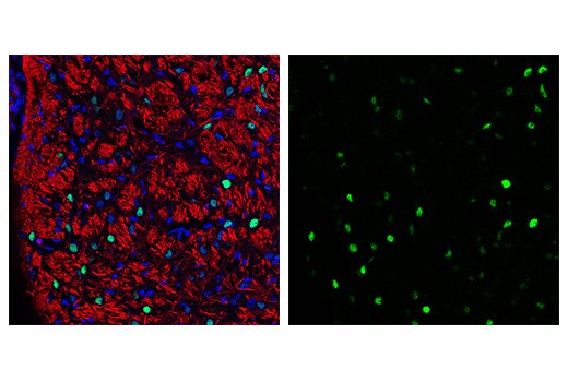 Immunofluorescence Image 2: c-Fos (9F6) Rabbit Monoclonal Antibody (BSA and Azide Free)