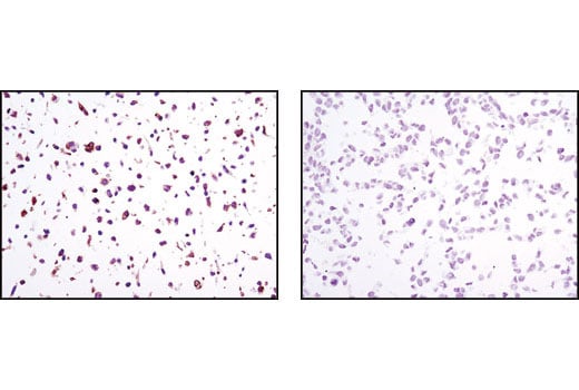 Immunohistochemistry Image 2: TrkB (80G2) Rabbit mAb