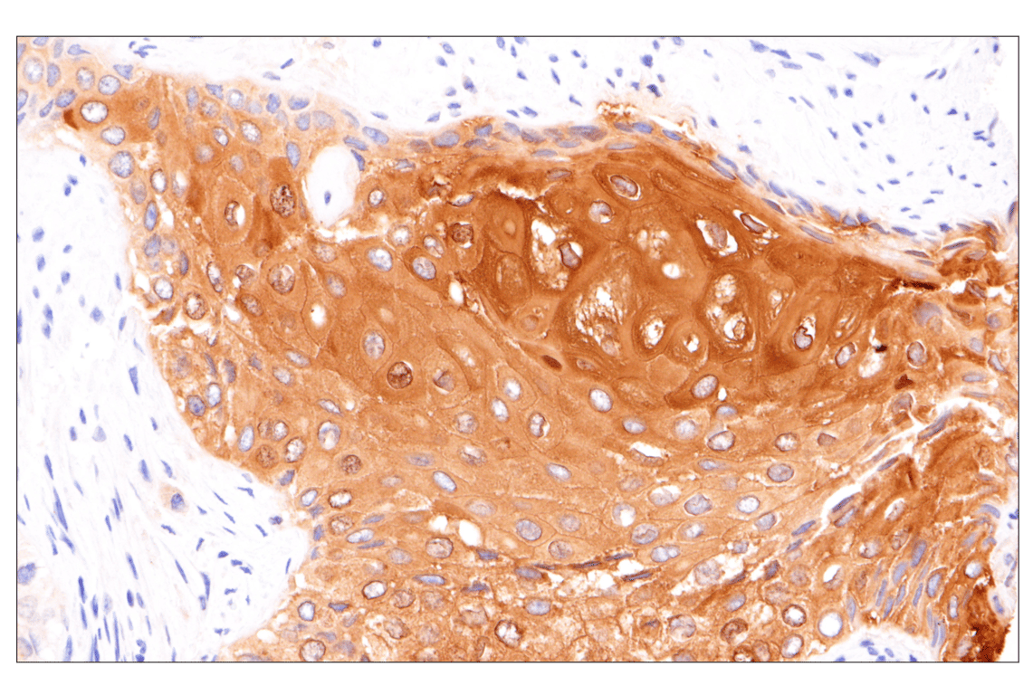 Immunohistochemistry Image 5: Involucrin (F9C3C) Rabbit Monoclonal Antibody