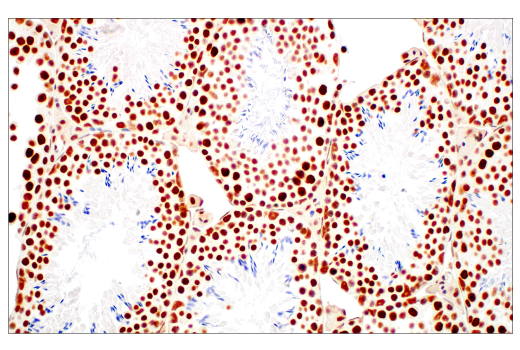 Immunohistochemistry Image 9: METTL3 (E3F2A) Rabbit Monoclonal Antibody (BSA and Azide Free)