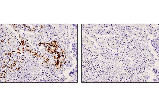 Immunohistochemistry Image 3: CD79A (D1X5C) Rabbit Monoclonal Antibody