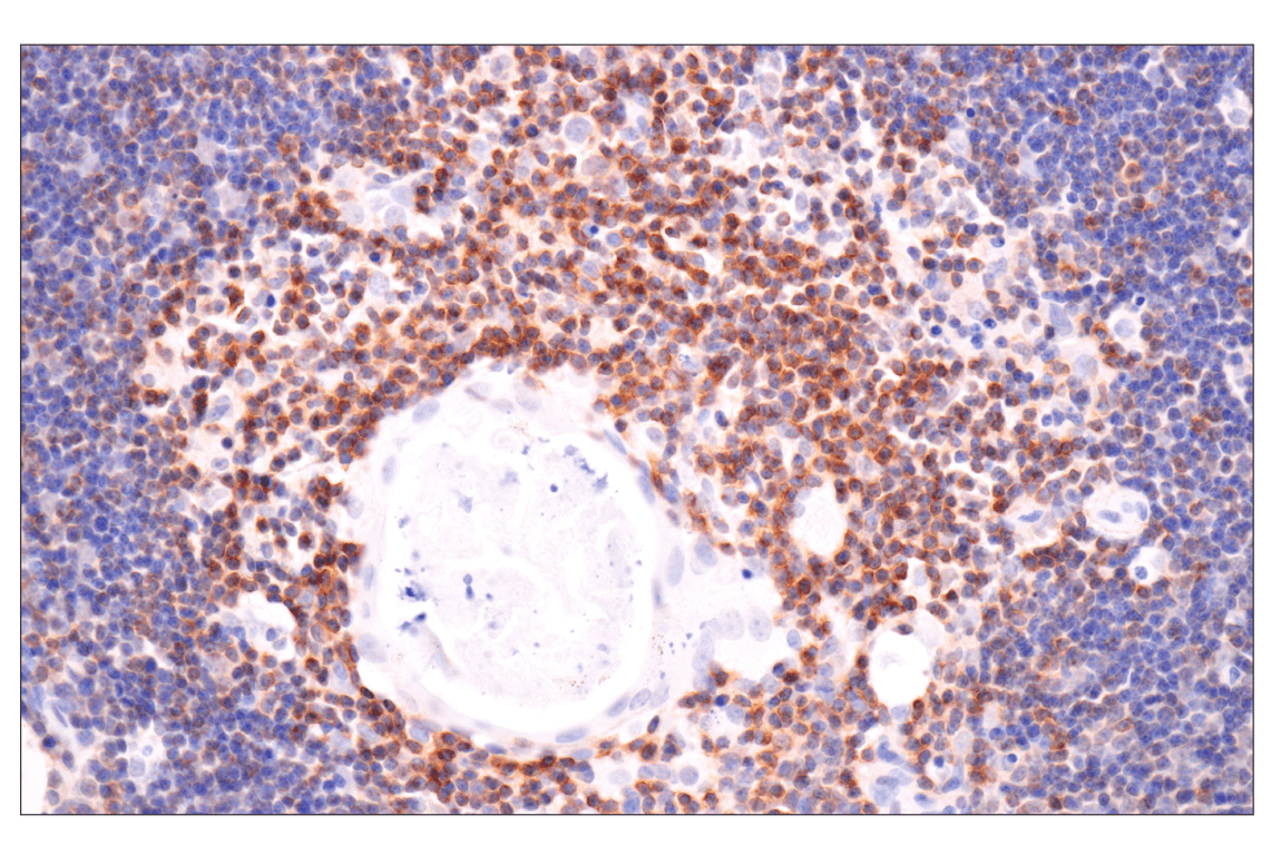 CXCR4 (D4Z7W) Rabbit Monoclonal Antibody | Cell Signaling Technology