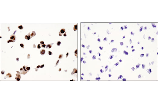 Immunohistochemistry Image 2: NKX3.1 (D6D2Z) Rabbit Monoclonal Antibody (BSA and Azide Free)