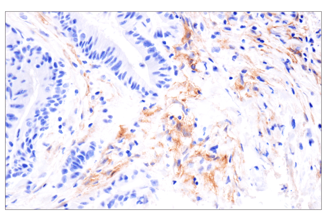 LRRC15 (E4X8J) Rabbit Monoclonal Antibody (BSA and Azide Free