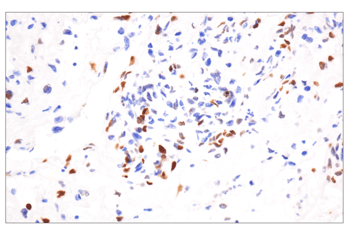 Immunohistochemistry Image 1: Phospho-Histone H2A.X (Ser139) (20E3) Rabbit Monoclonal Antibody