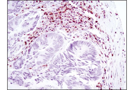 Immunohistochemistry Image 2: NFAT1 (D43B1) Rabbit Monoclonal Antibody