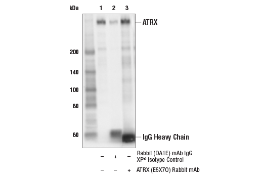 Immunoprecipitation Image 1: ATRX (E5X7O) Rabbit Monoclonal Antibody