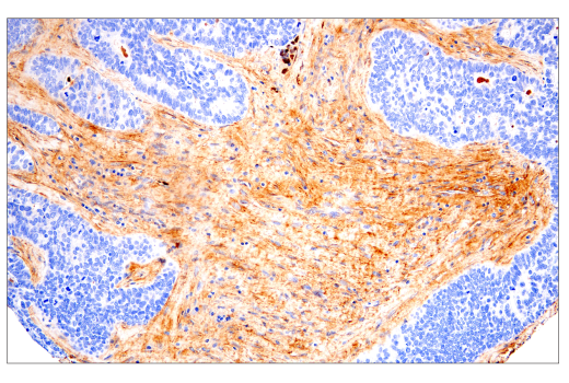 Immunohistochemistry Image 1: Fibronectin/FN1 (E5H6X) Rabbit Monoclonal Antibody (BSA and Azide Free)