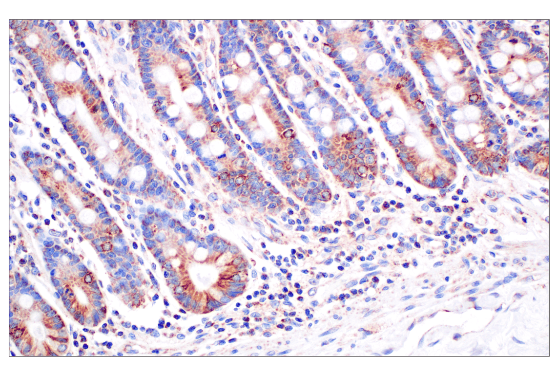 Immunohistochemistry Image 4: CPT1A (E3Y1V) Rabbit Monoclonal Antibody
