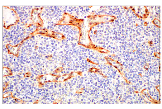 Immunohistochemistry Image 5: PLVAP (E3X9D) Rabbit Monoclonal Antibody