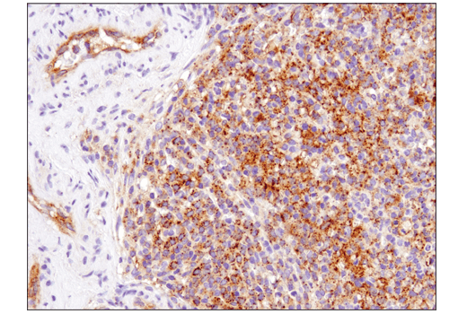 Immunohistochemistry Image 5: MX1 (D3W7I) Rabbit Monoclonal Antibody