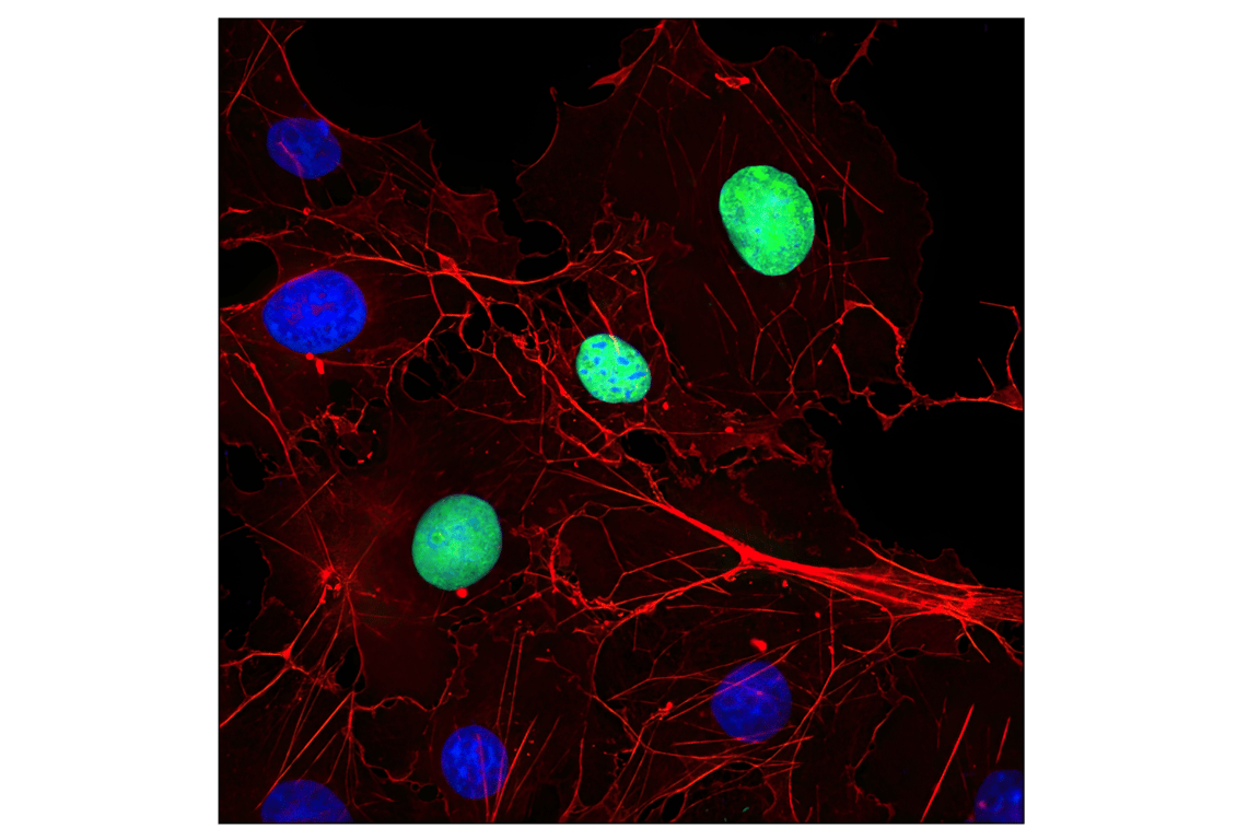 Immunofluorescence Image 1: Myc-Tag (9B11) Mouse mAb