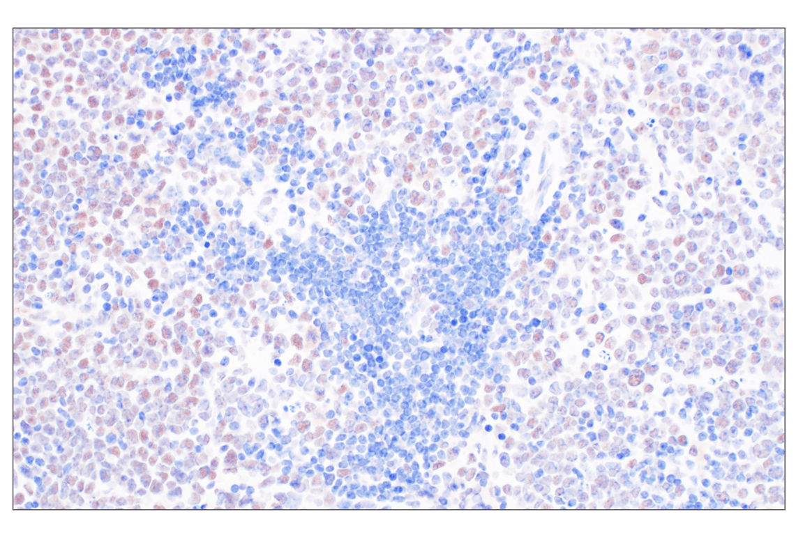 Immunohistochemistry Image 6: HDAC2 (3F3) Mouse Monoclonal Antibody