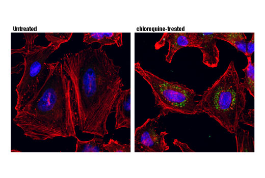 Immunofluorescence Image 1: GABARAPL1 (D5R9Y) Rabbit Monoclonal Antibody (BSA and Azide Free)