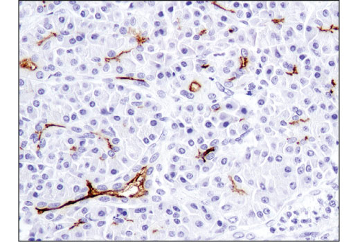 Immunohistochemistry Image 4: CD133 (D4W4N) Rabbit Monoclonal Antibody (BSA and Azide Free)