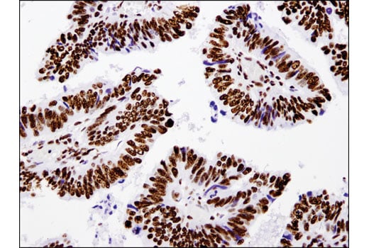 Immunohistochemistry Image 3: Acetyl-Histone H3 (Lys18) (D8Z5H) Rabbit Monoclonal Antibody
