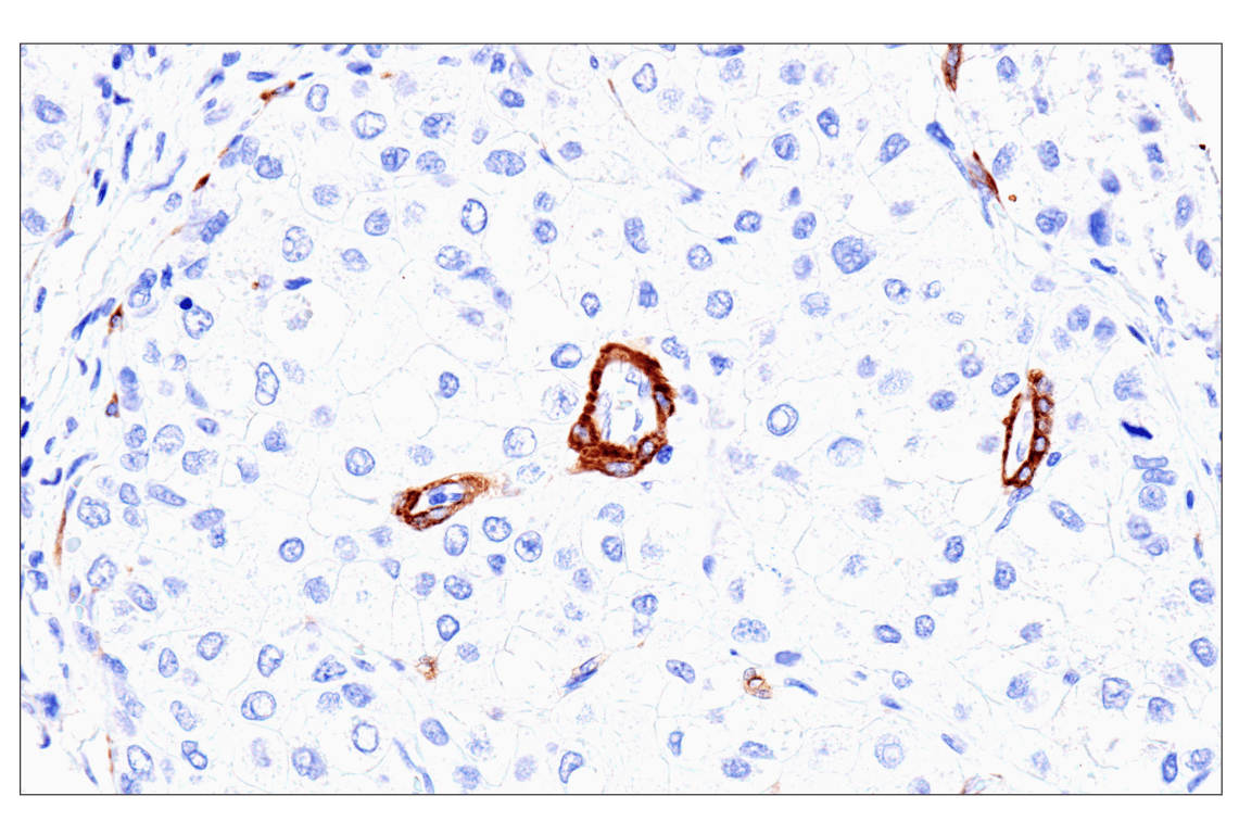 Immunohistochemistry Image 2: MYH11 (E4N8M) Rabbit Monoclonal Antibody (BSA and Azide Free)