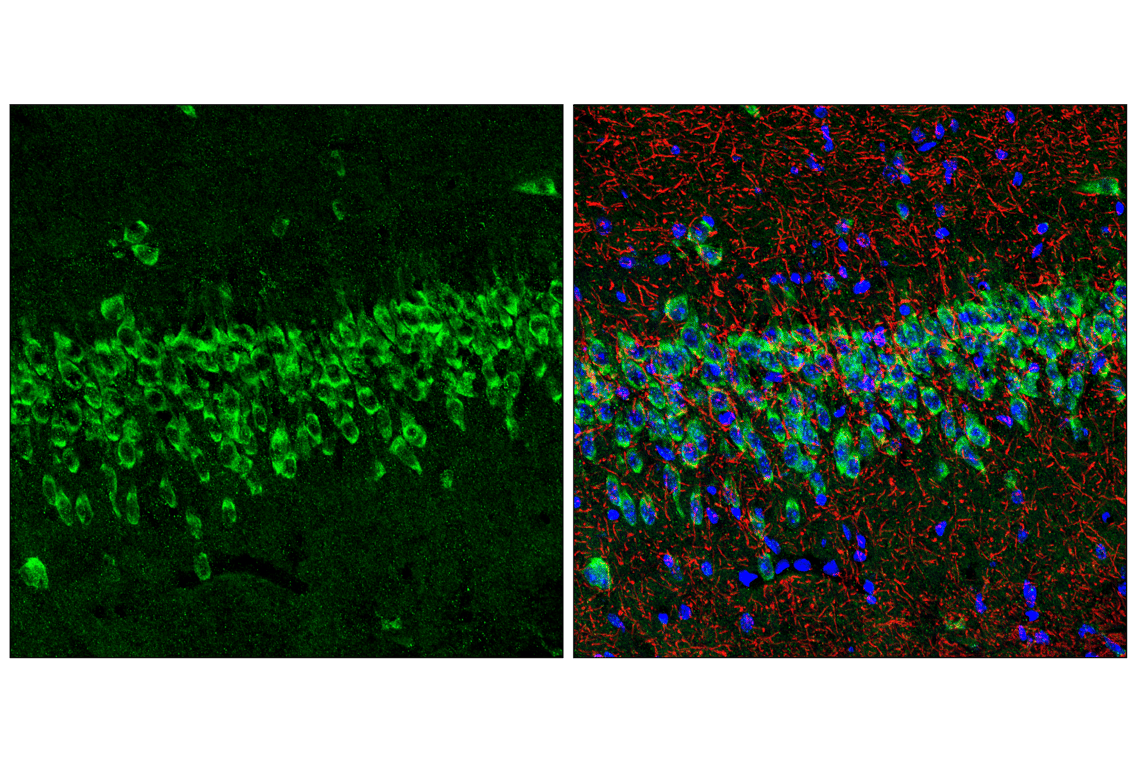 Immunofluorescence Image 1: ROBO2 (E4M6D) Rabbit Monoclonal Antibody