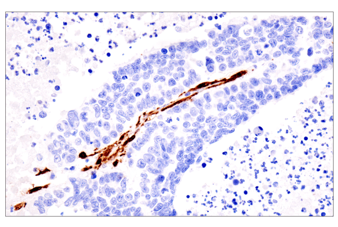 Immunohistochemistry Image 9: Transgelin/TAGLN (F3B7H) Rabbit Monoclonal Antibody