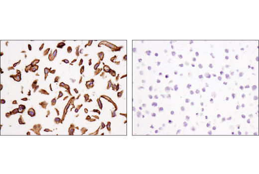 Immunohistochemistry Image 2: PVR/CD155 (D8A5G) Rabbit Monoclonal Antibody
