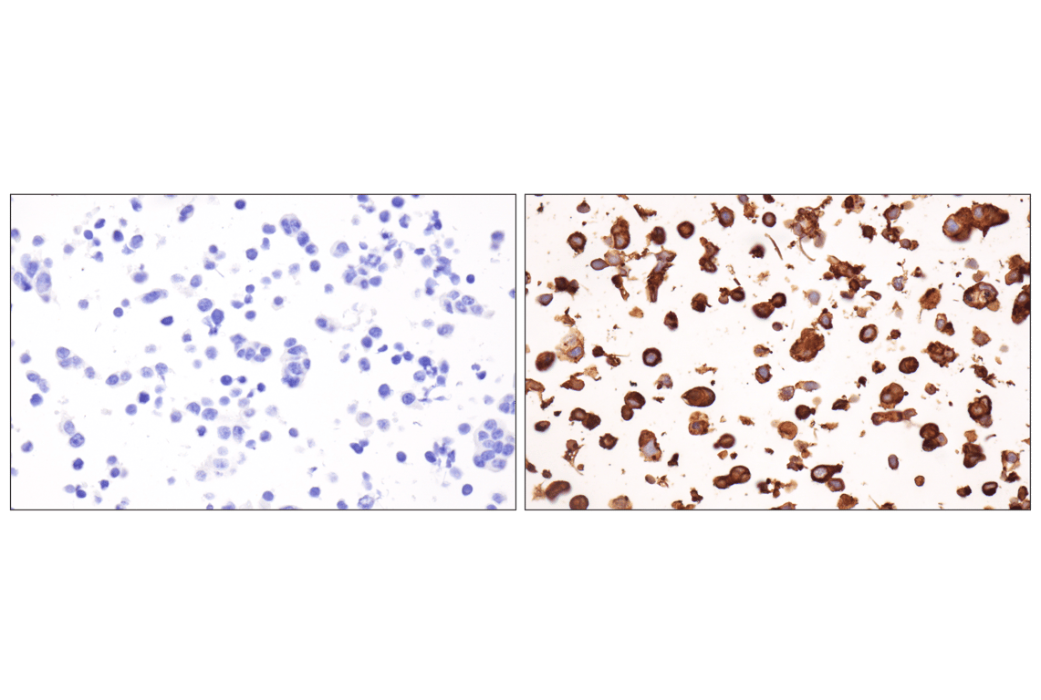 Immunohistochemistry Image 8: PD-L1 (F3Z1T) Rabbit Monoclonal Antibody (BSA and Azide Free)