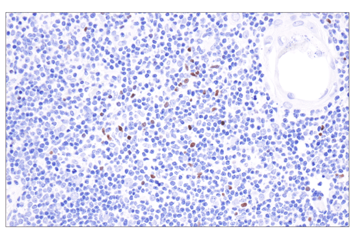 Immunohistochemistry Image 7: FoxP3 (221D) Mouse Monoclonal Antibody