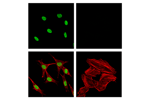 Immunofluorescence Image 1: Sox10 (E2V9N) Rabbit Monoclonal Antibody (BSA and Azide Free)