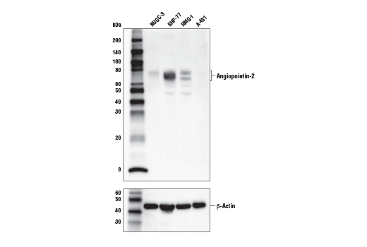 undefined Image 5: Cancer-associated Growth Factor Antibody Sampler Kit