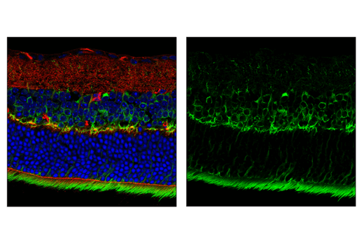 Immunofluorescence Image 2: MAP7 Antibody