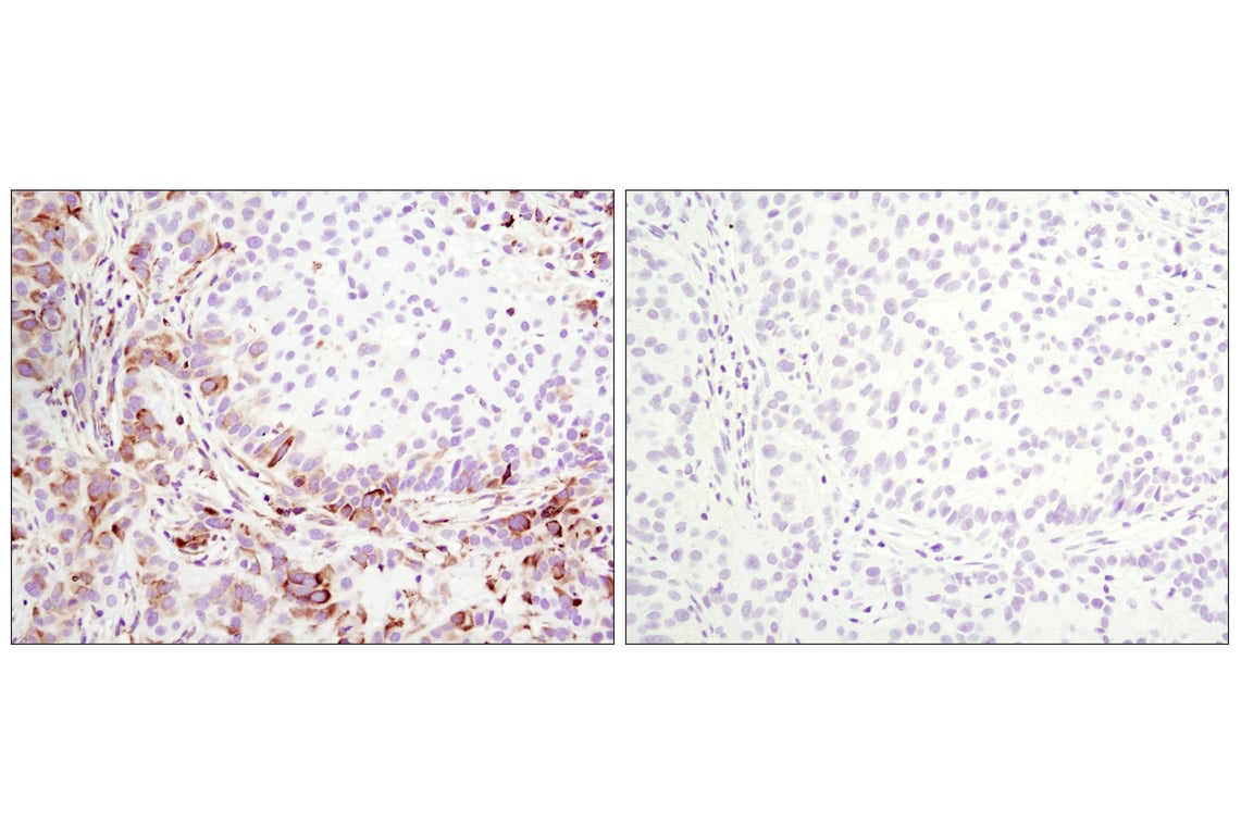 Immunohistochemistry Image 5: Phospho-S6 Ribosomal Protein (Ser235/236) (D57.2.2E) Rabbit Monoclonal Antibody (BSA and Azide Free)