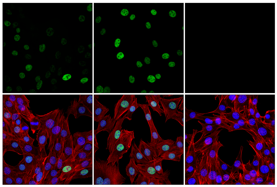 Immunofluorescence Image 1: p21 Waf1/Cip1 (F2C7C) Rabbit Monoclonal Antibody