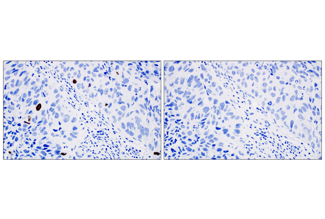 Immunohistochemistry Image 3: Phospho-Histone H3 (Ser10) (D7N8E) Rabbit Monoclonal Antibody