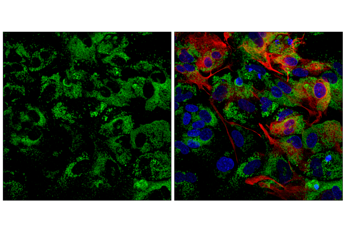undefined Image 53: Organelle Localization IF Antibody Sampler Kit