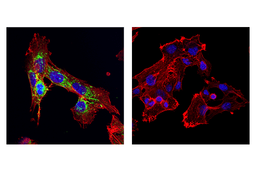 undefined Image 36: ECM Profiling Antibody Sampler Kit
