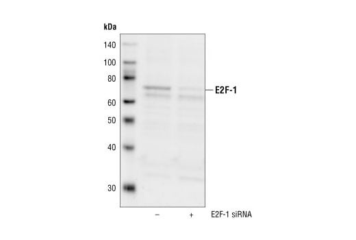 Western Blotting Image 2: E2F-1 Antibody